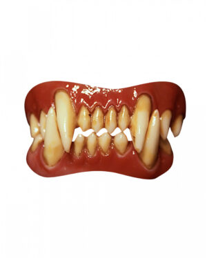 Dental FX Veneers Werwolf Zähne
